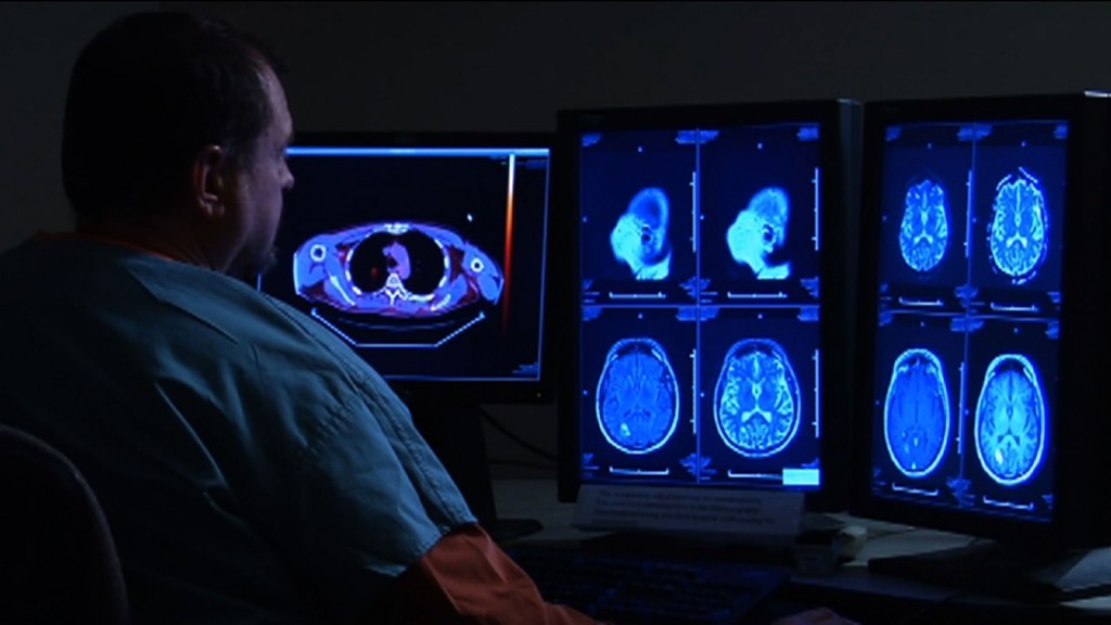 Studying Symptoms and Treatments of Concussions