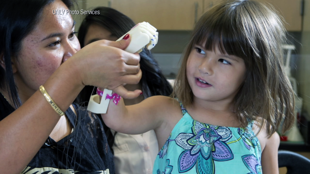 Engineer 3D-Prints Hand for Five-Year-Old