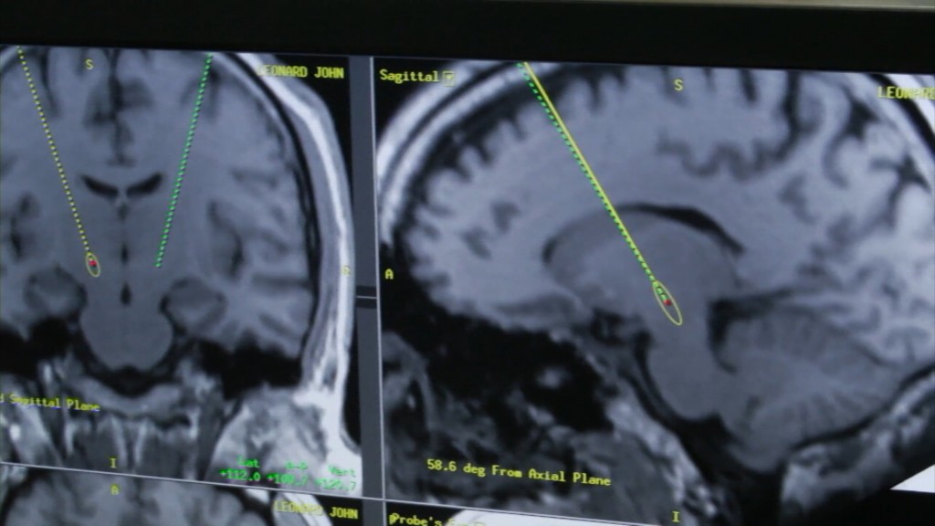‘Concussion’ Brings Awareness to Traumatic Brain Injuries in Sports