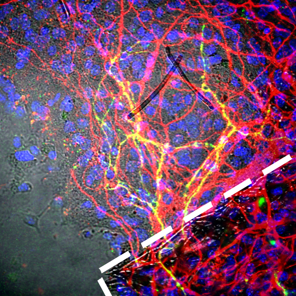 Future Brain Therapies for Parkinson’s Possible with Stem Cell Bioengineering Innovation