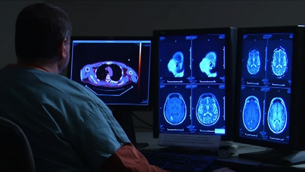 Research: 40 Percent of Former NFL Players Have Brain Damage
