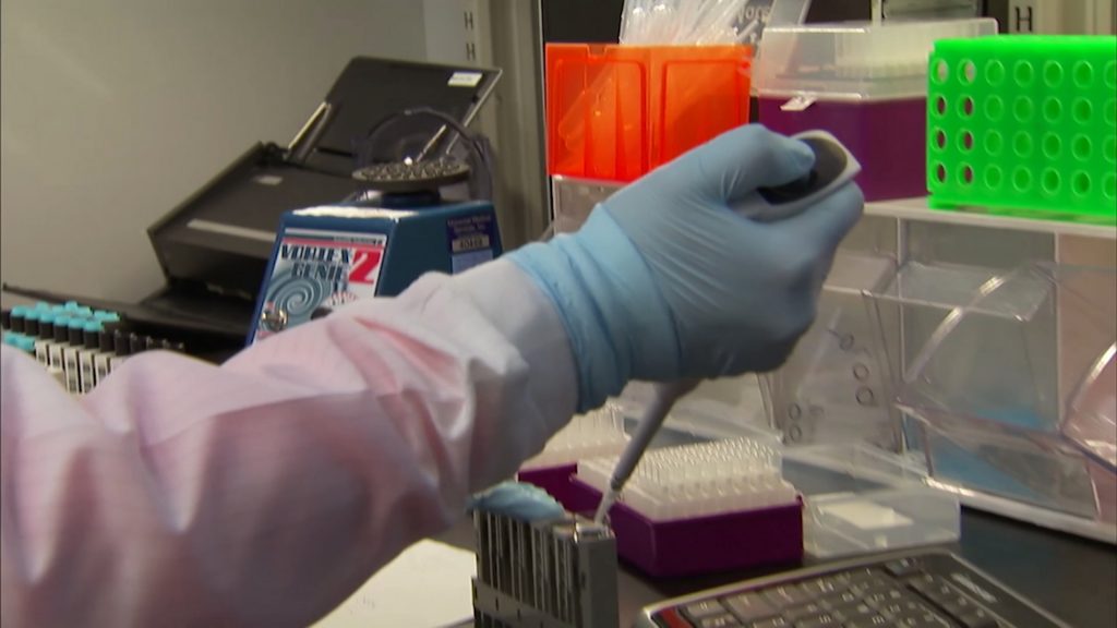 Doctors Discuss Alzheimer’s Advancements