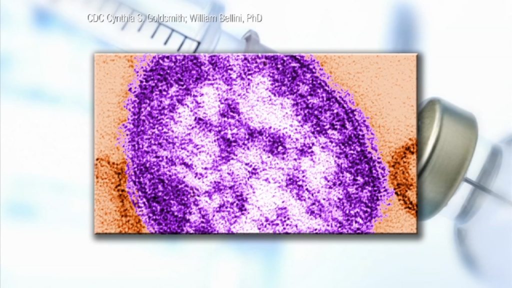 Even in the Age of Vaccines Measles Outbreaks Can Occur