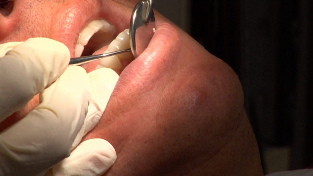 The Role of Dentists in the Growing Opioid Addiction Crisis