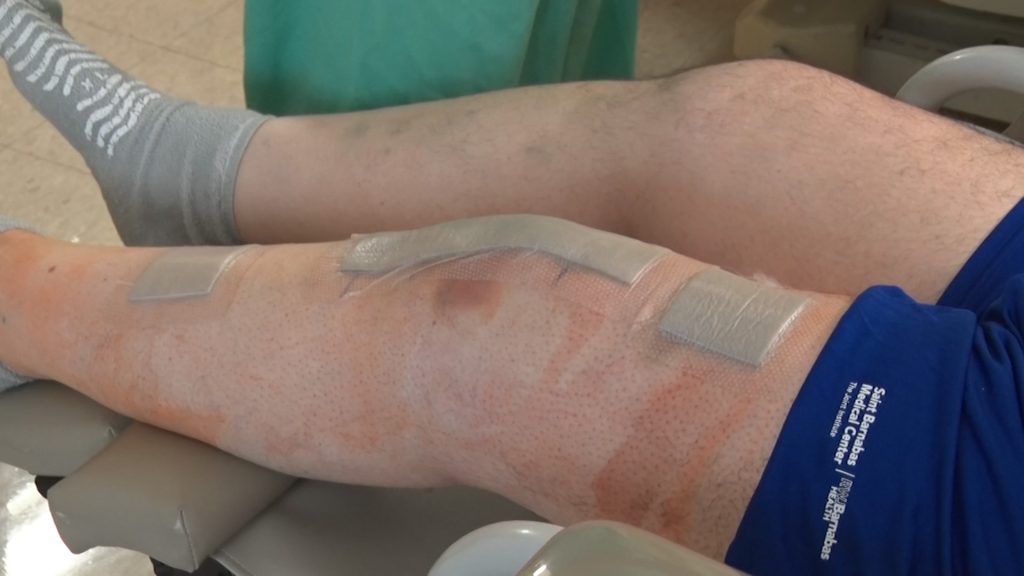 How cryoanesthesia and robots are helping stem the opioid epidemic
