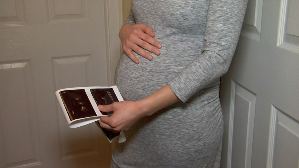 Report finds NJ hospitals are performing too many C-sections