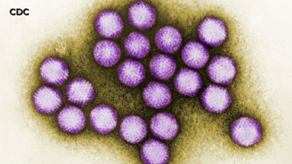 Child death toll hits 7 in viral outbreak at rehab center
