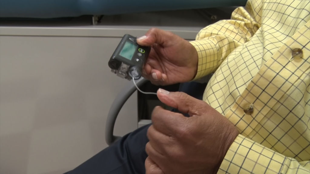Diabetes is a silent disease, often delaying proper diagnosis
