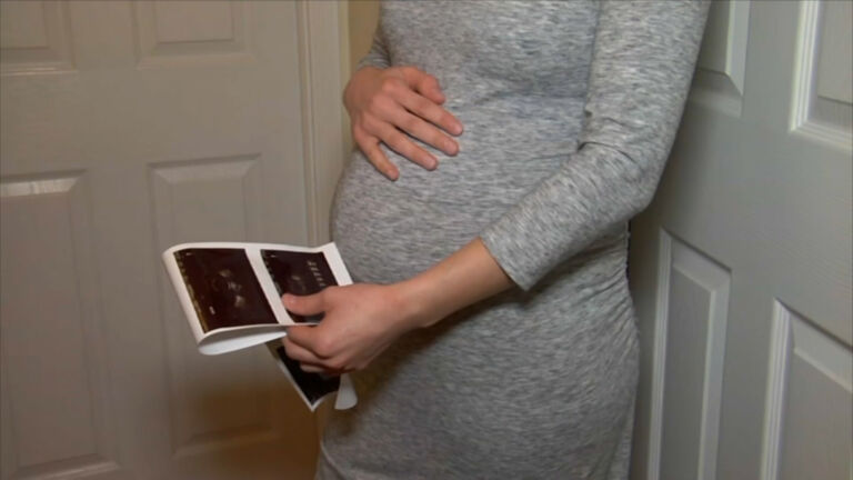 Experts fear pandemic’s impact on maternal mortality rates