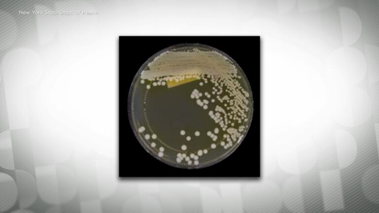 Warning of threat posed by Candida auris, a drug-resistant fungus