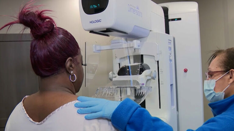 Mammograms should start at age 40, new recommendation