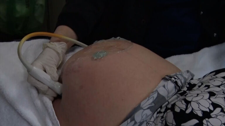 Is lead exposure adding to NJ’s maternal deaths?