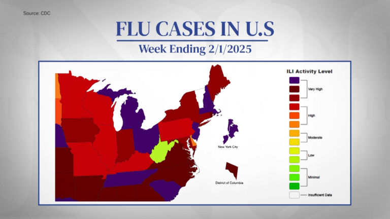 Flu cases on the rise in NJ